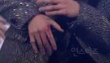BTS' Jungkook's severe cut on Music Bank