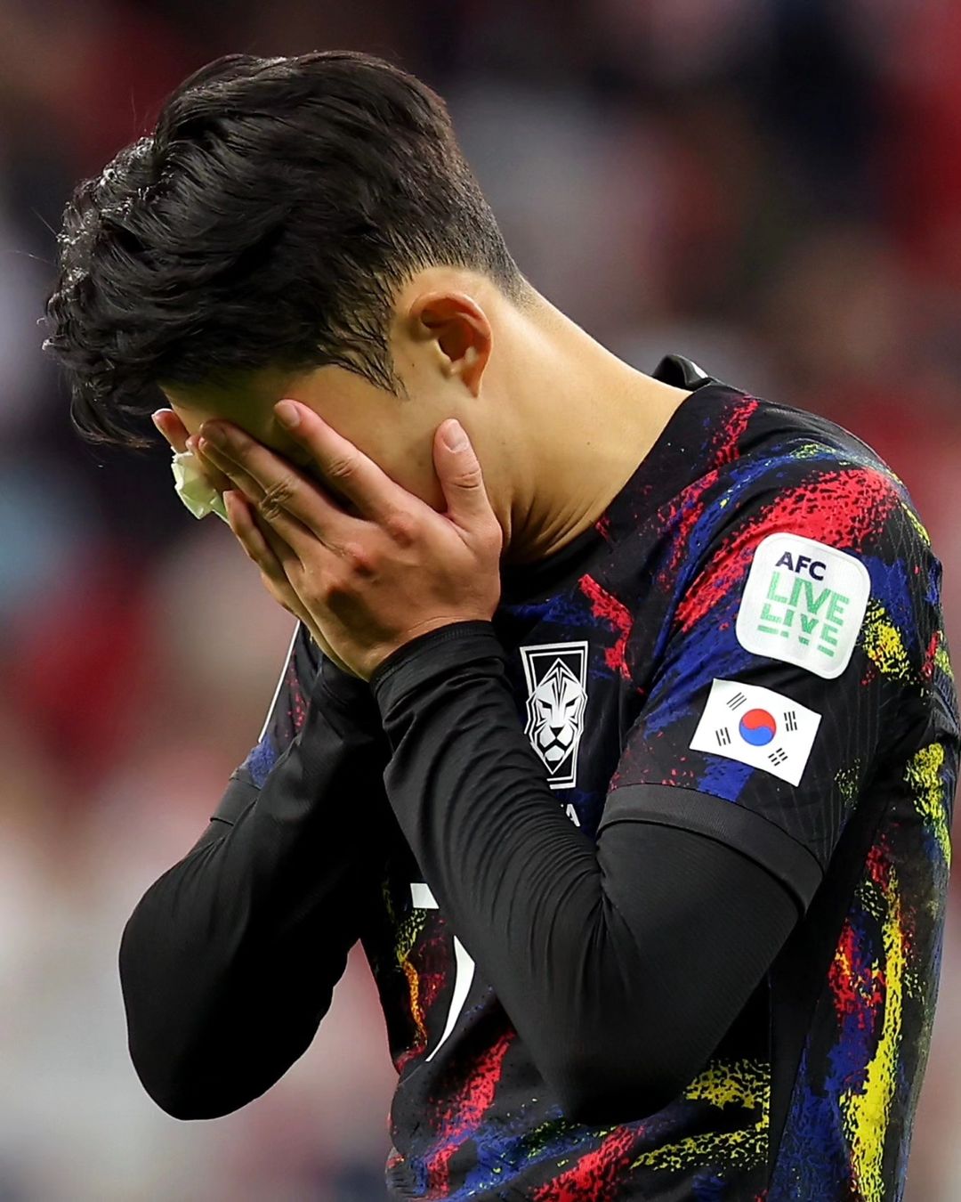 Injured hand pictured