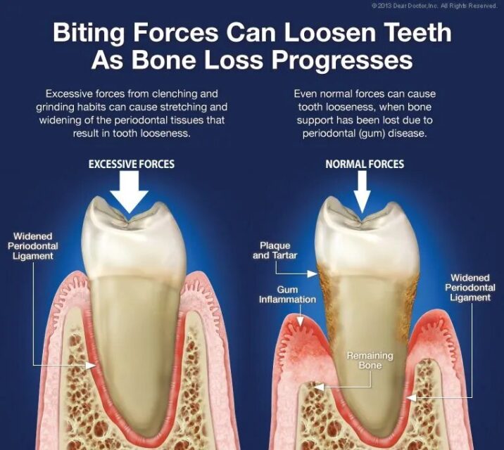 biting-forces-1920w.jpg