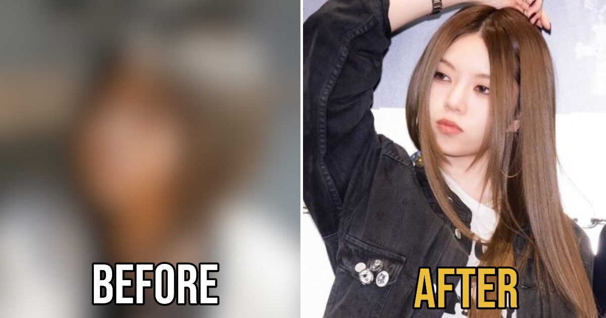 Past Photos Of ALLDAY PROJECT Bailey’s Trigger Plastic Surgery Debate