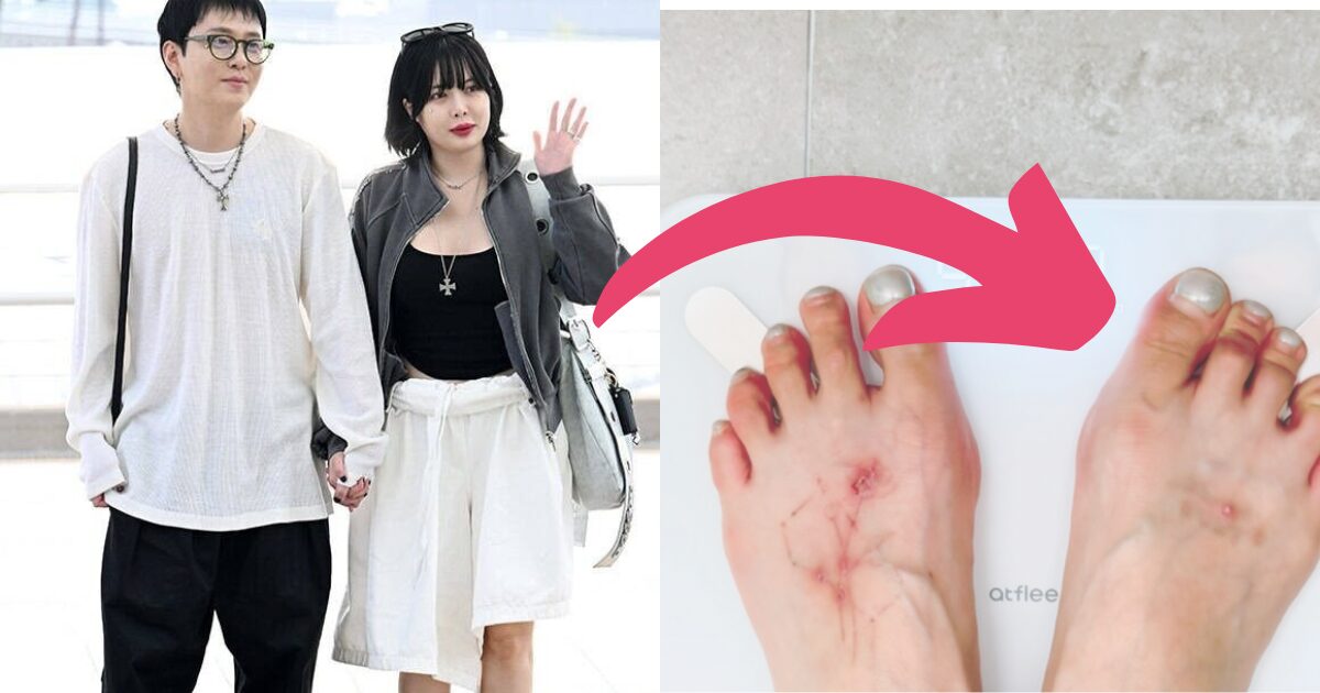 HyunA Flaunts Immense Weight Loss After Scathing Criticism About Body