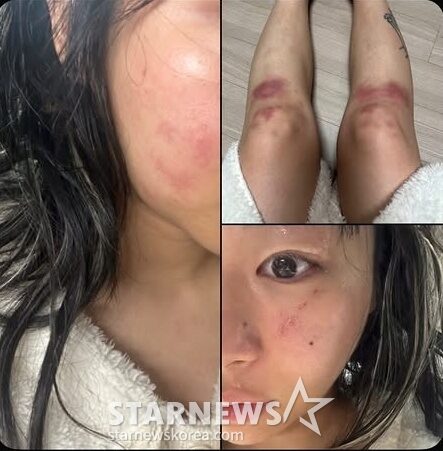 0003392286_001_20251215104608834