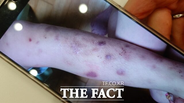 2025940176432161510_20251201080017941