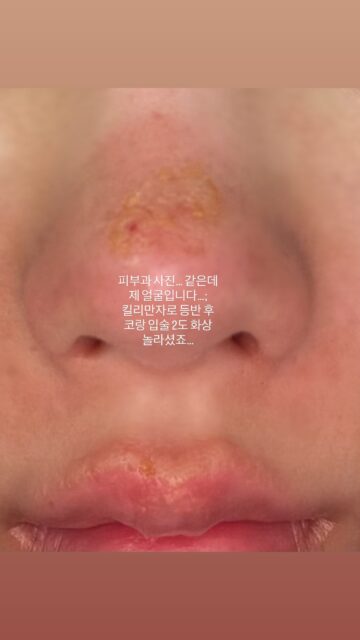 627166450_18078355844585182_2522970030061666221_n