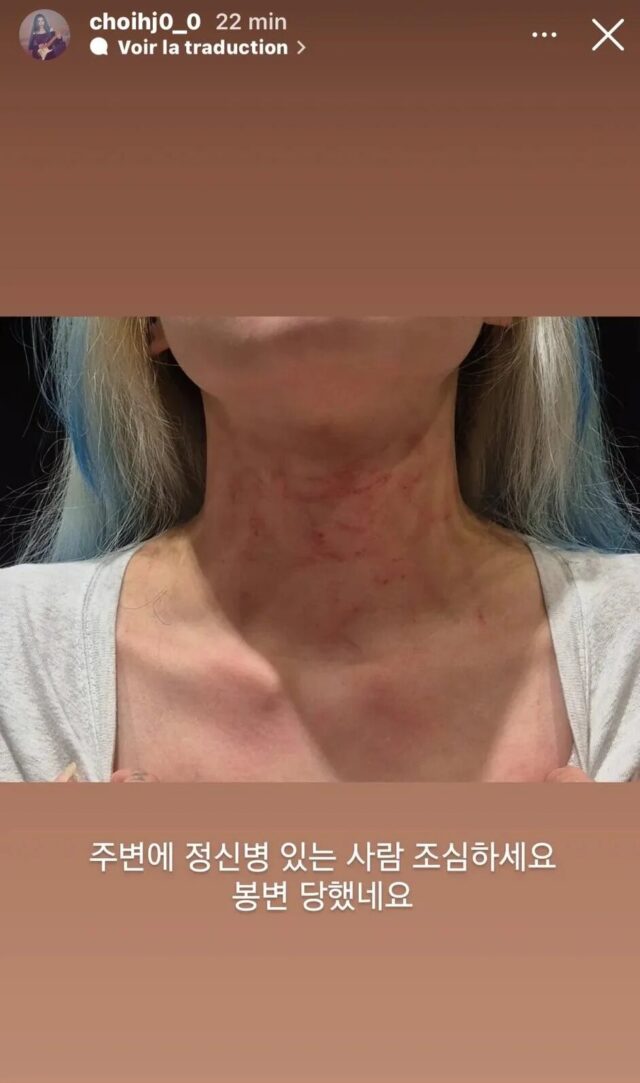 rolling-quartzs-hyunjung-has-shared-on-instagram-stories-v0-7abxxkt301qg1