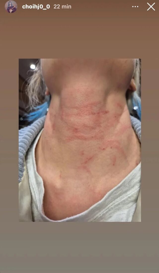 rolling-quartzs-hyunjung-has-shared-on-instagram-stories-v0-mqlwmi1401qg1