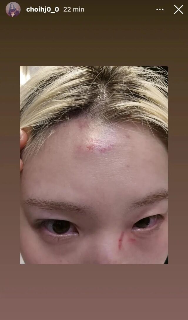 rolling-quartzs-hyunjung-has-shared-on-instagram-stories-v0-ssnjoc5401qg1