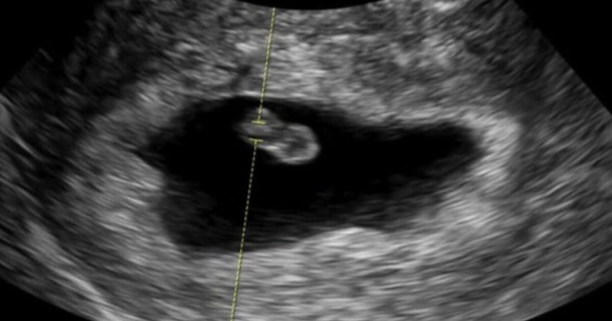 Actor-Idol Couple Announces Pregnancy Following Previous Miscarriage