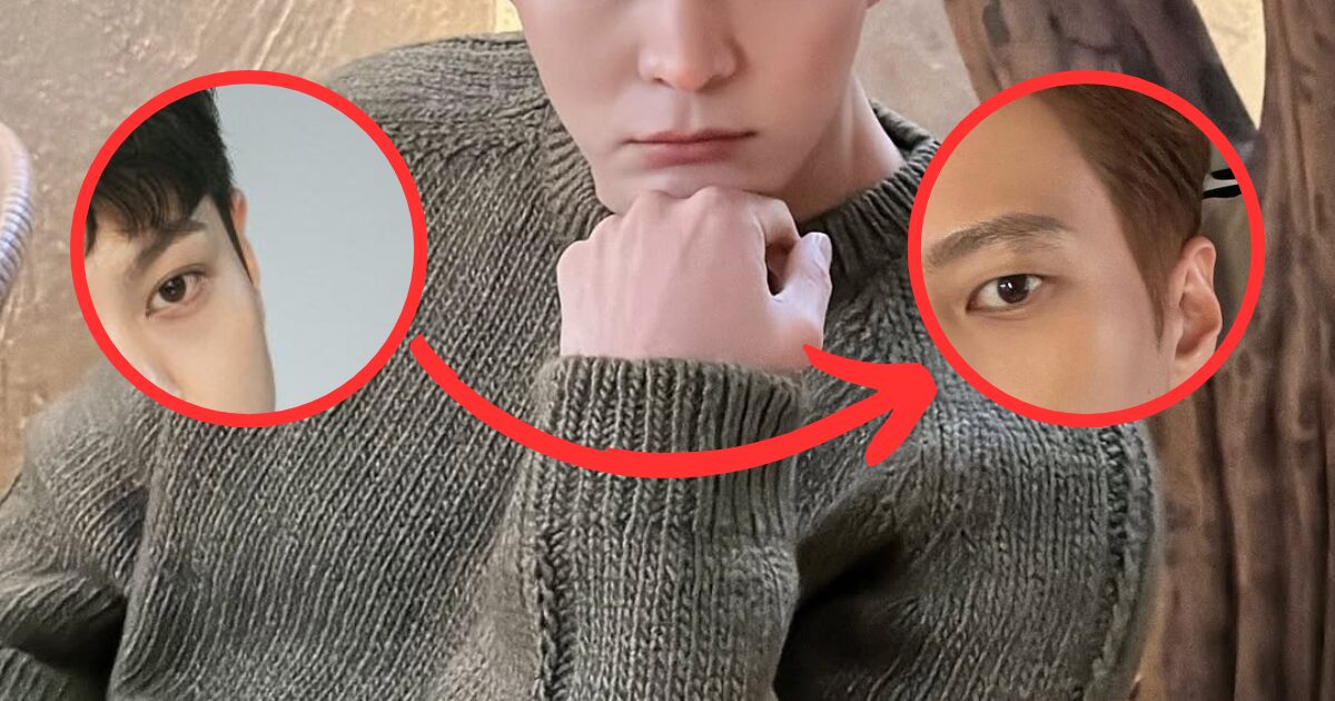 Top Actor “Cancelled” His Plastic Surgery And Returned Back To His Youthful Looks