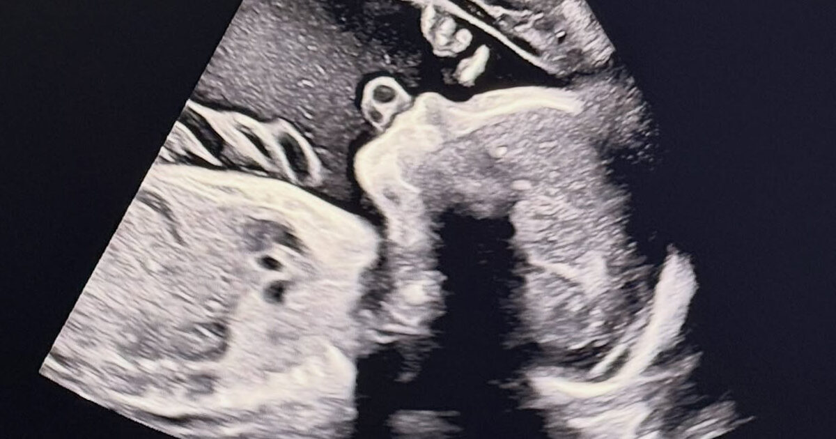 Idol-Turned-Actor Expecting First Child After Sudden Retirement And Departure From Korea