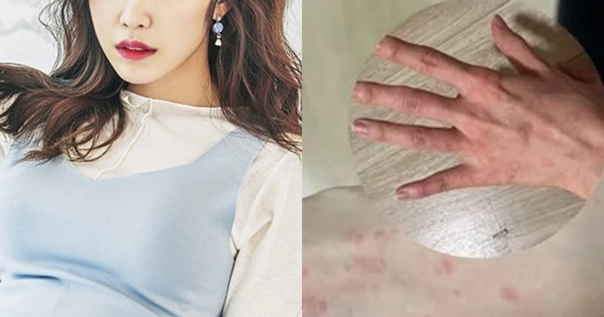 Idol-Turned-Actress Sparks Major Concern With Recent Photos