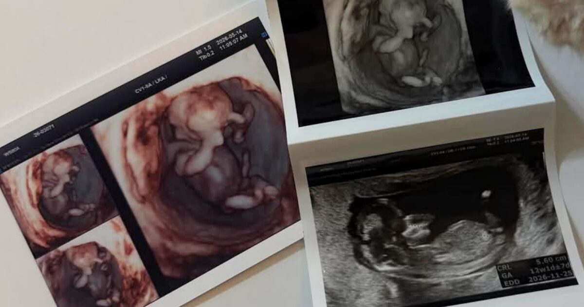 21-Year-Old Active Musician Announces Premarital Pregnancy