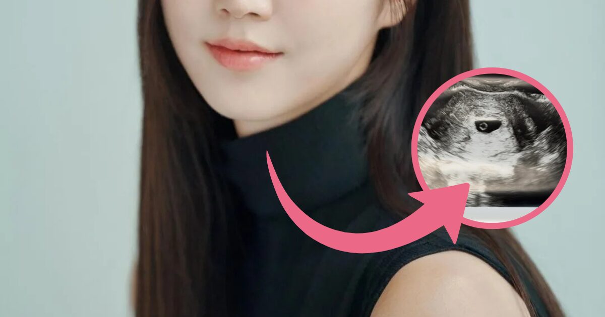 Former Top Girl Group Member Makes Surprise Pregnancy Announcement插图