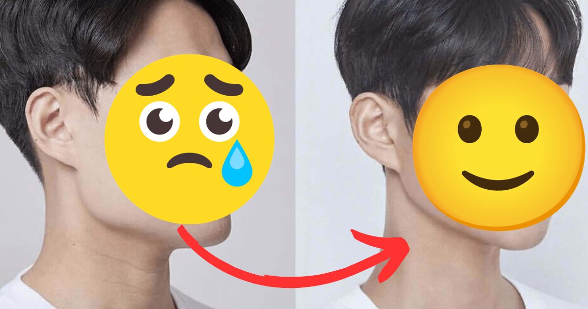 From “Spongebob” To Idol-Esque — The Korean Bus Driver Who Transformed His Visuals With Plastic Surgery插图