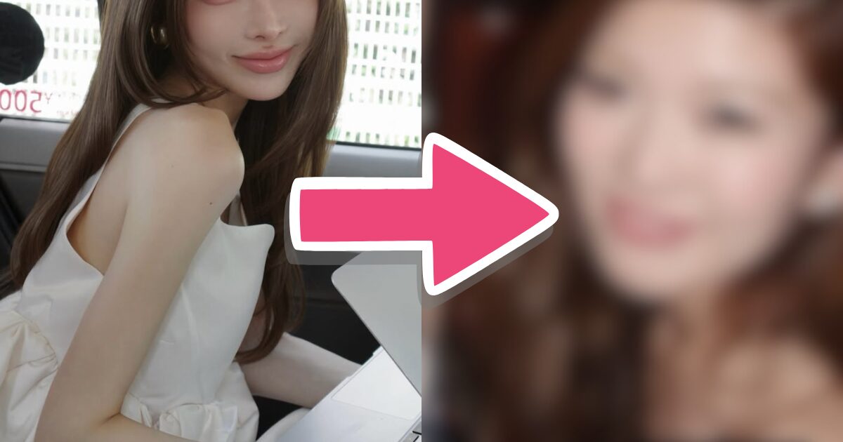 Gallery - Top Beauty Influencer's Shocking "Pre-Plastic Surgery" Photos Get Exposed - Koreaboo - image 3