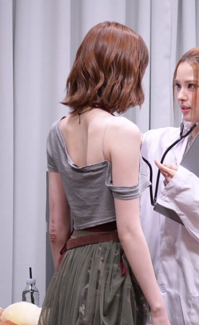 Gallery - Fifth-Gen Female Idol’s Huge Scar Sparks Major Concern - Koreaboo - image 1