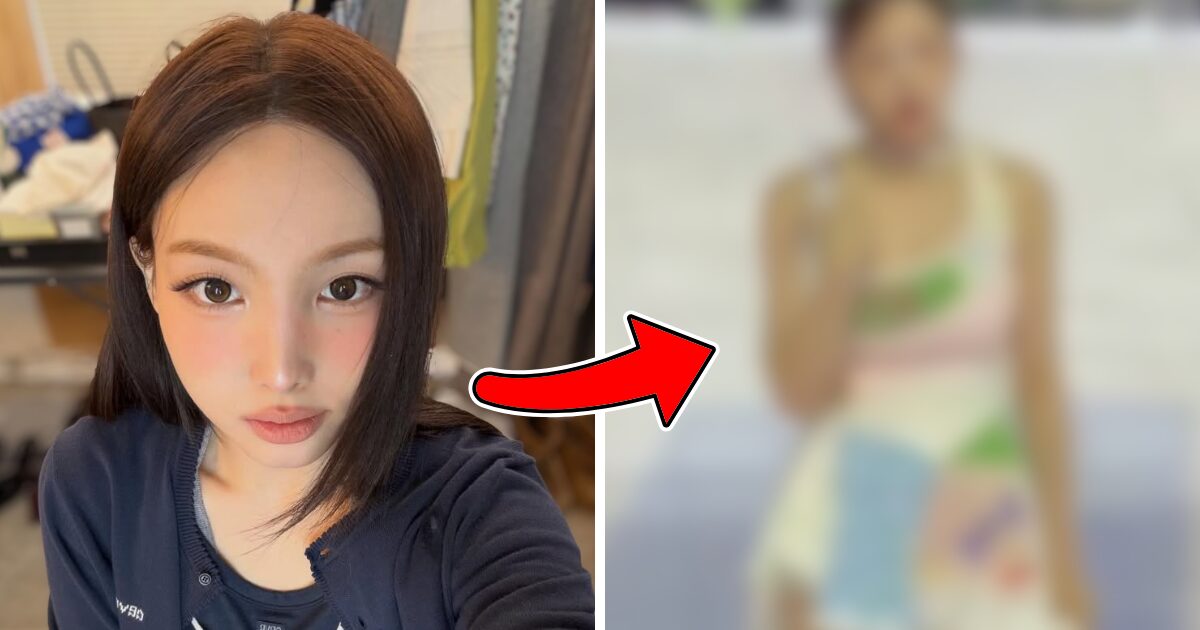 TWICE Nayeon’s Shocking Appearance On Stage Sparks Massive Concerns