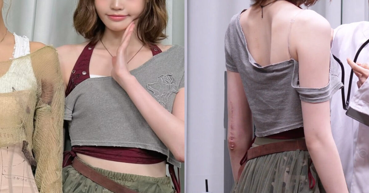 Gallery - Fifth-Gen Female Idol’s Huge Scar Sparks Major Concern - Koreaboo - image 4