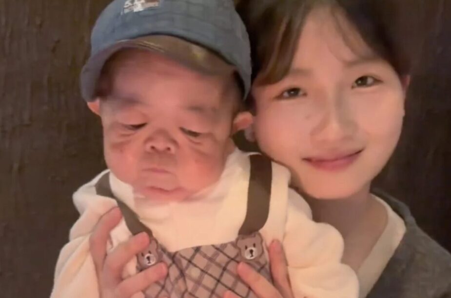 Baby-Sized 25-Year-Old Chinese Man Goes Viral