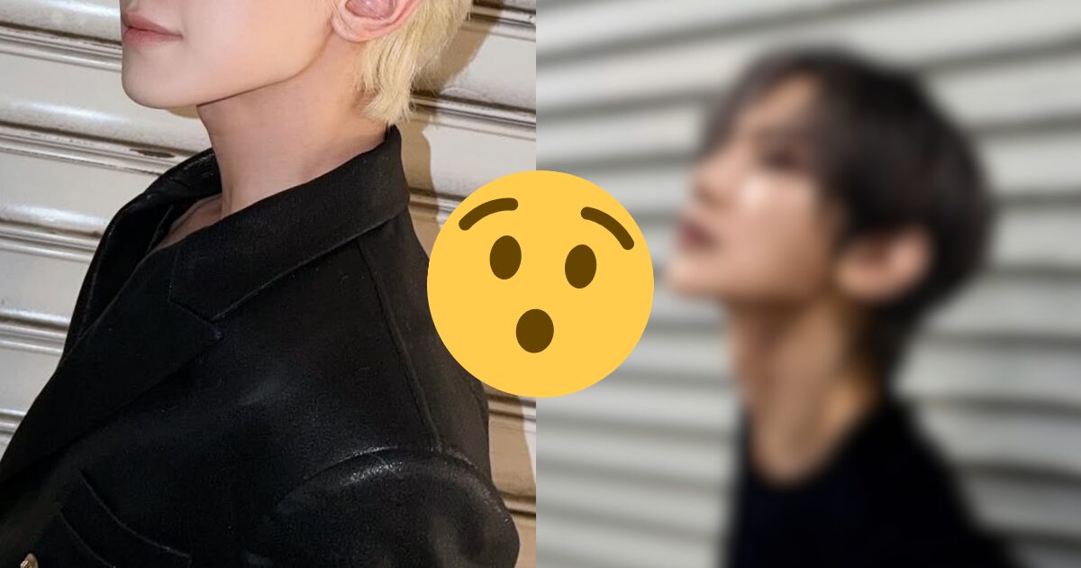 Popular 4th Gen Idol Hit With Cosmetic Procedure Allegations, Triggering Debate