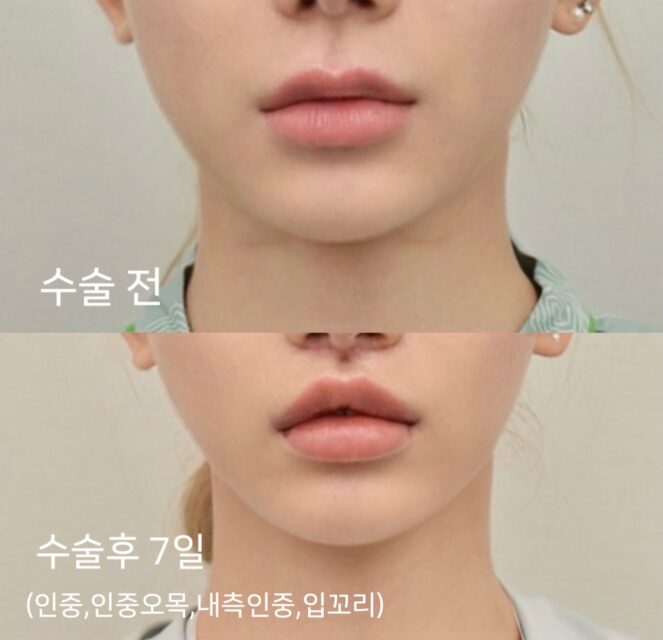 Maeng Seung Ji 4