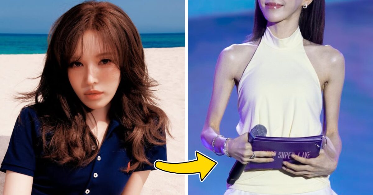 Red Velvet Wendy’s “Real” Appearance Sparks Massive Shock And Concern 