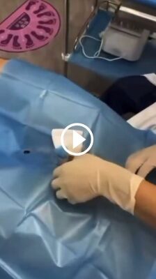 Top Actor Faces Accusations Of Failed Penis Growth Procedure