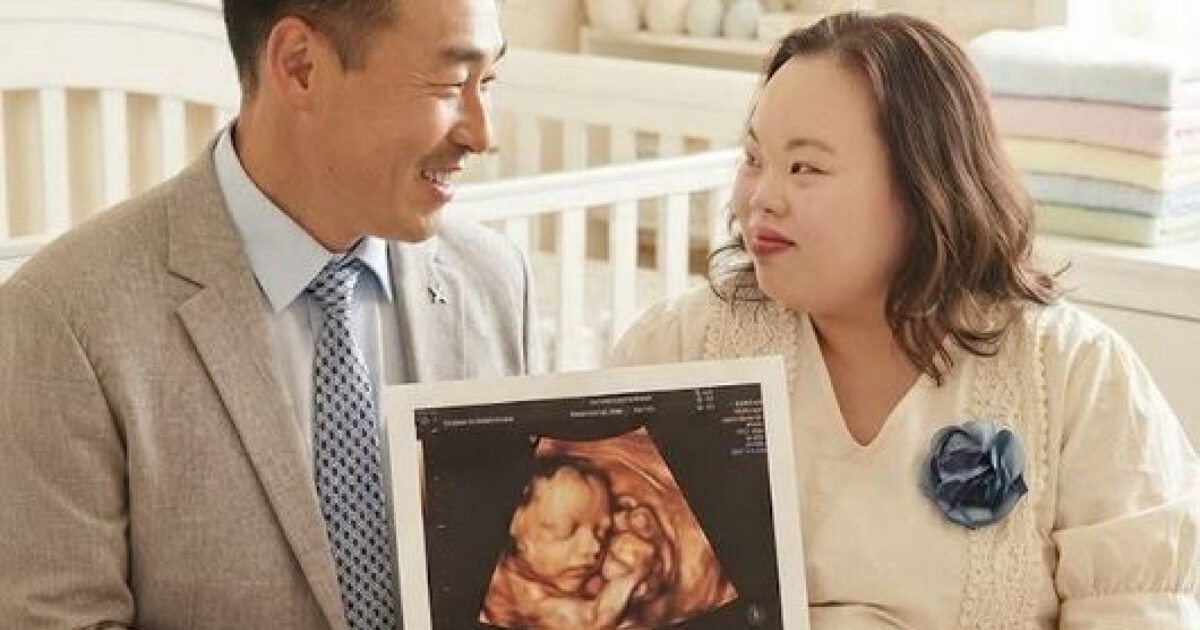 Famous Actress With Down Syndrome Shocks With Ultrasound Image