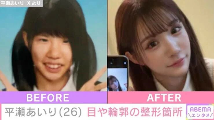 Woman Spends A Fortune On 25 Plastic Surgeries To Turn Into A Model Face插图4 gNzpxj