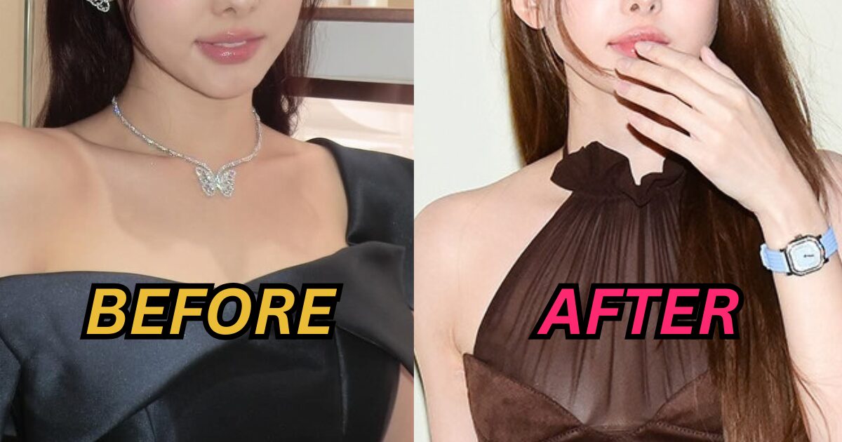 Top Girl Group Idol Catches Plastic Surgery Accusations After Recent Public Appearance