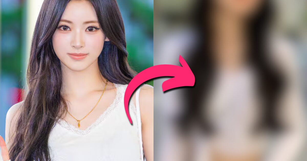 MEOVV’s Anna Catches Plastic Surgery Allegations